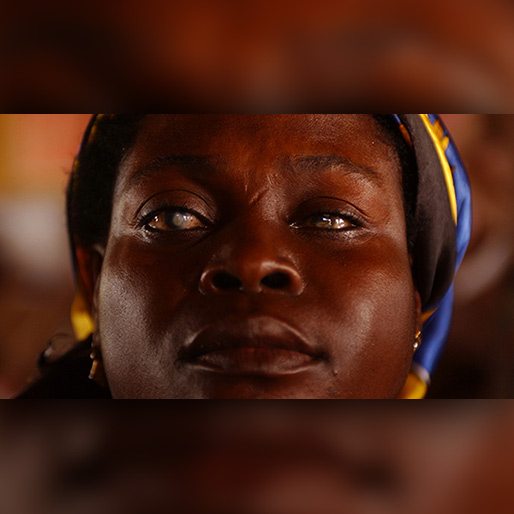 African Woman with glaucoma